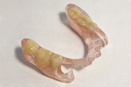 ノンクラスプデンチャー